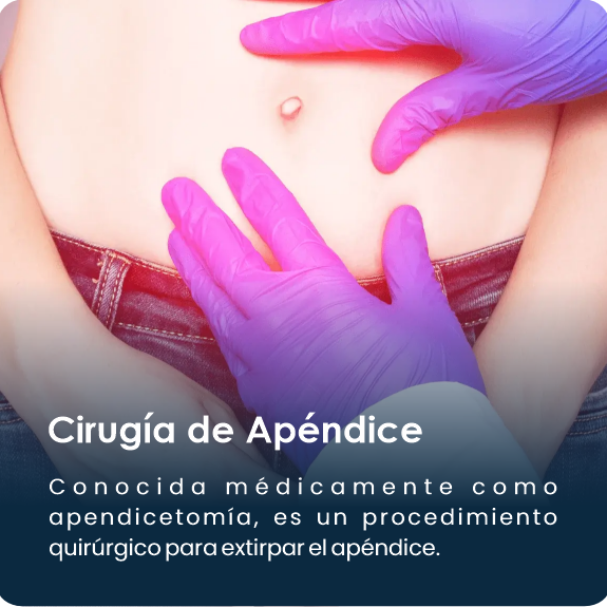 Cirugia_de_apendice2